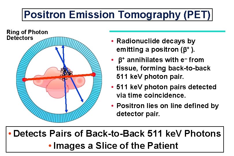 Positron Emission Tomography (PET) Ring of Photon Detectors • Radionuclide decays by emitting a