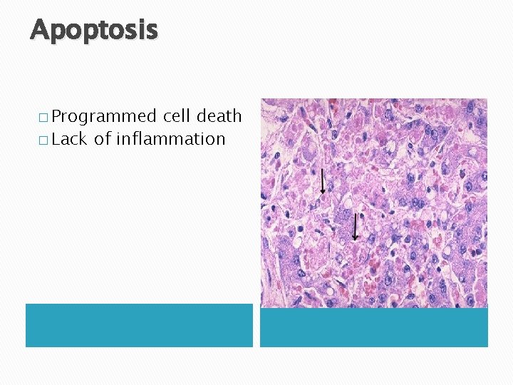 Apoptosis � Programmed cell death � Lack of inflammation Apoptosis � Programmed cell death � Lack of inflammation