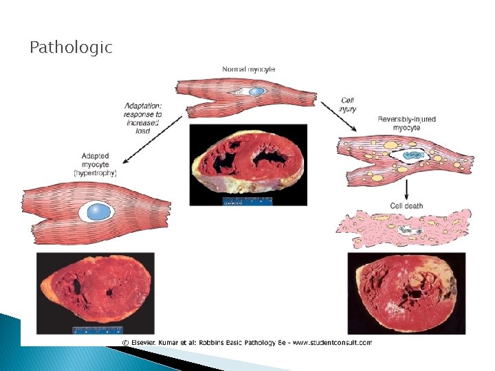 Pathologic Pathologic