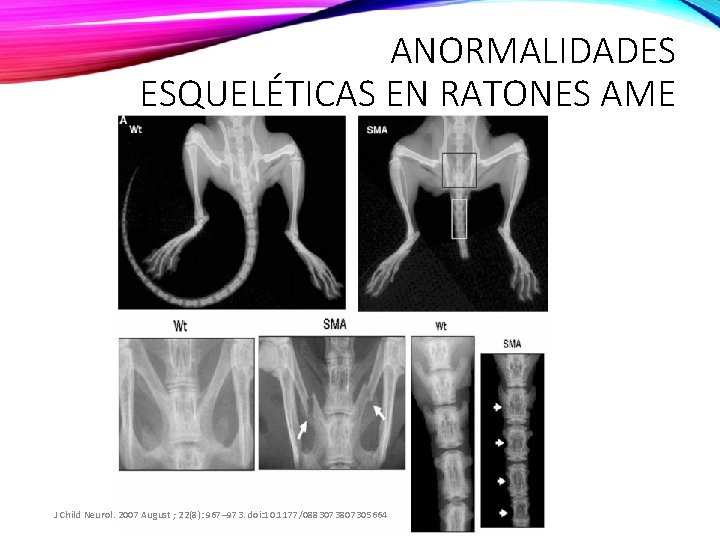 ANORMALIDADES ESQUELÉTICAS EN RATONES AME J Child Neurol. 2007 August ; 22(8): 967– 973.