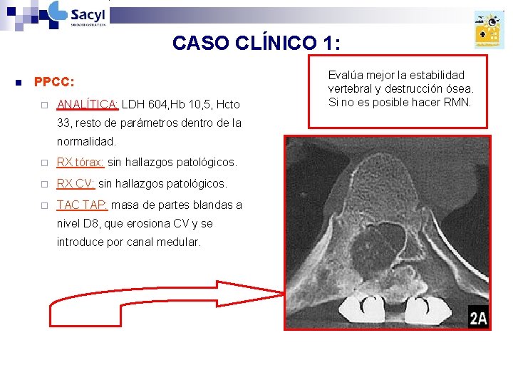 CASO CLÍNICO 1: n PPCC: ¨ ANALÍTICA: LDH 604, Hb 10, 5, Hcto 33, CASO CLÍNICO 1: n PPCC: ¨ ANALÍTICA: LDH 604, Hb 10, 5, Hcto 33,