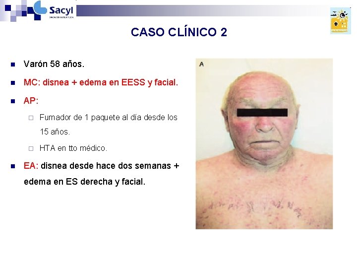 CASO CLÍNICO 2 n Varón 58 años. n MC: disnea + edema en EESS CASO CLÍNICO 2 n Varón 58 años. n MC: disnea + edema en EESS