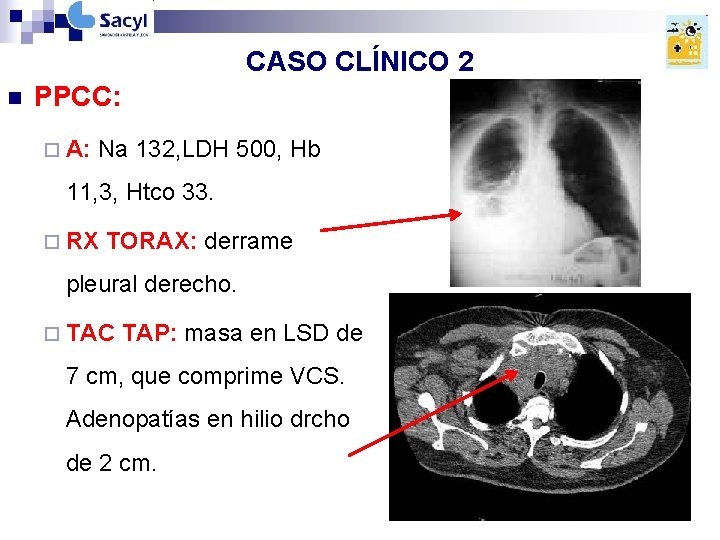 CASO CLÍNICO 2 n PPCC: ¨ A: Na 132, LDH 500, Hb 11, 3, CASO CLÍNICO 2 n PPCC: ¨ A: Na 132, LDH 500, Hb 11, 3,