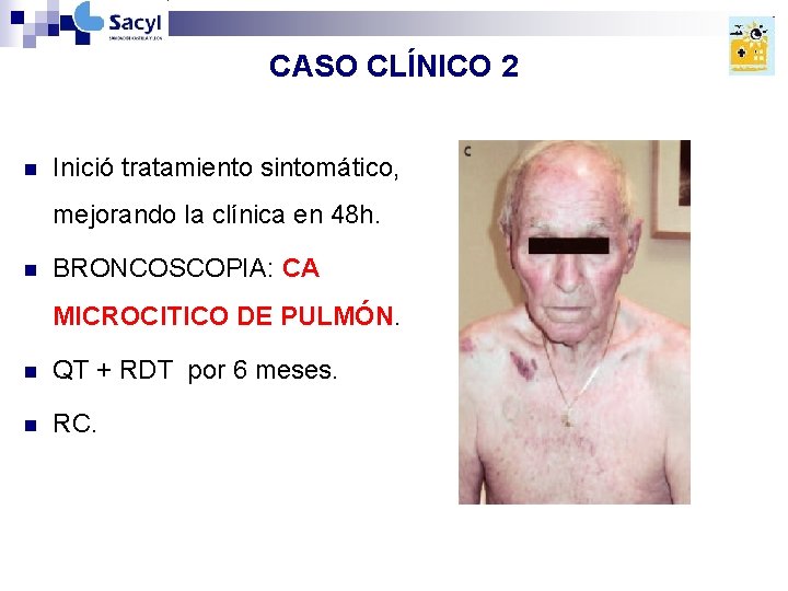 CASO CLÍNICO 2 n Inició tratamiento sintomático, mejorando la clínica en 48 h. n CASO CLÍNICO 2 n Inició tratamiento sintomático, mejorando la clínica en 48 h. n