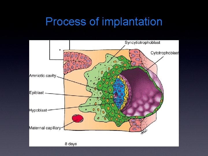 Process of implantation 