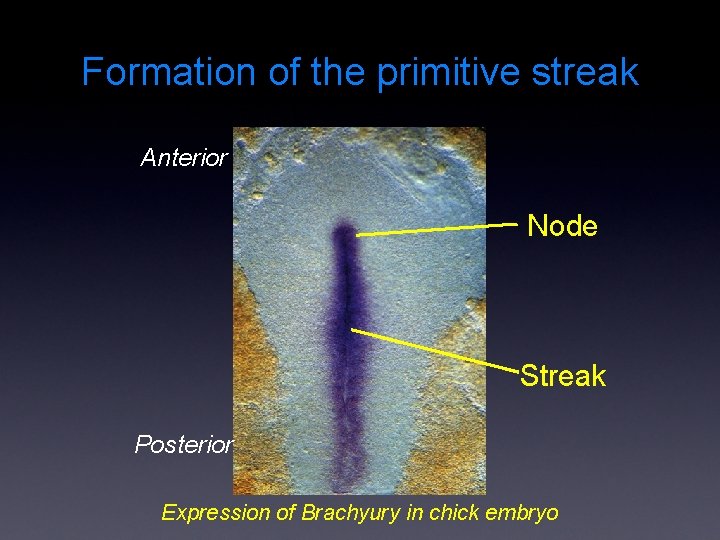 Formation of the primitive streak Anterior Node Streak Posterior Expression of Brachyury in chick