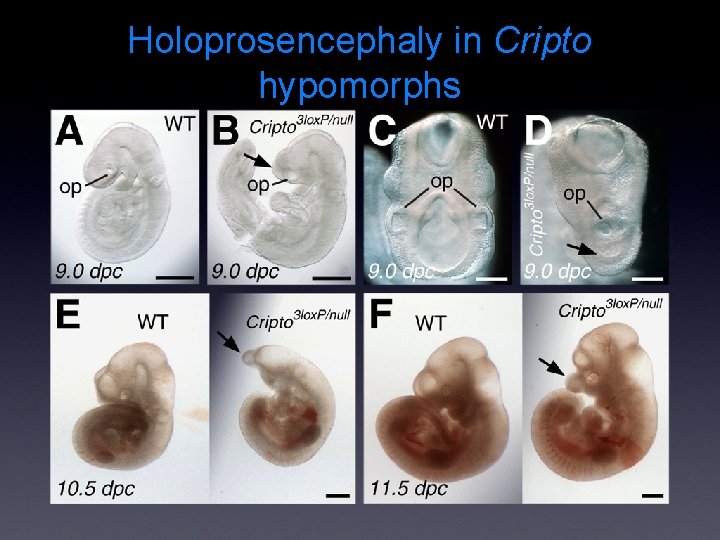 Holoprosencephaly in Cripto hypomorphs 