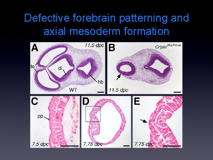 Defective forebrain patterning and axial mesoderm formation 
