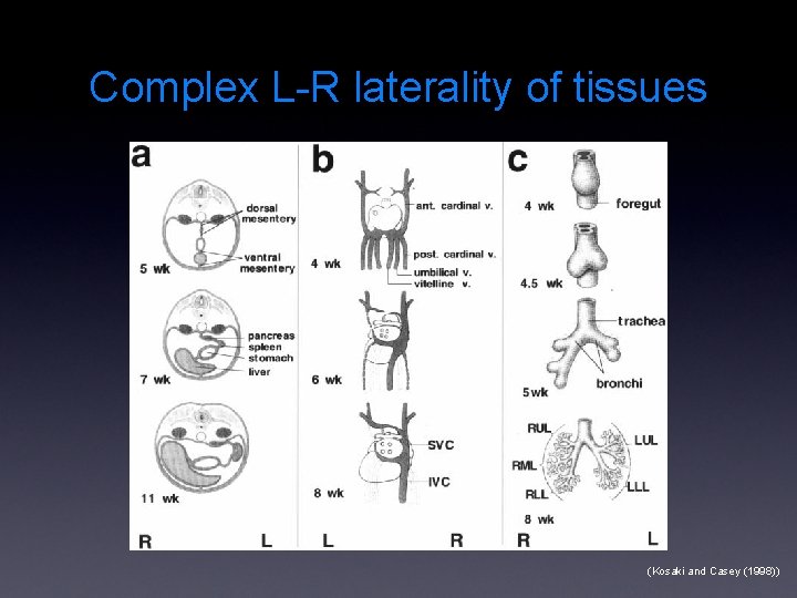 Complex L-R laterality of tissues (Kosaki and Casey (1998)) 
