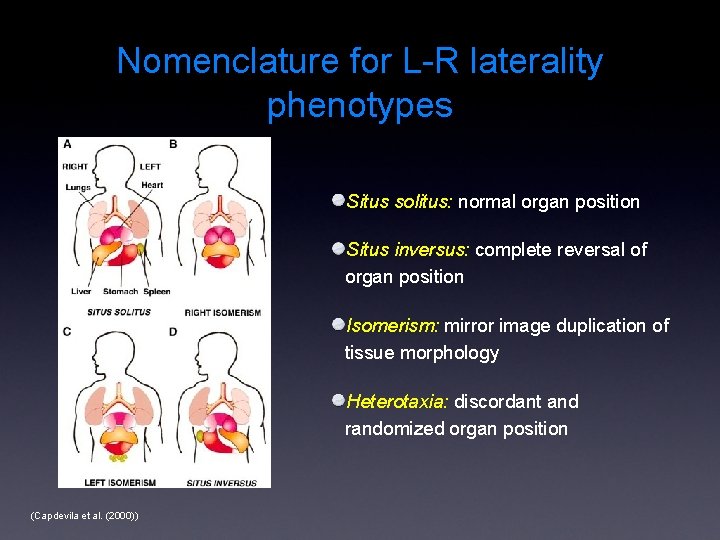 Nomenclature for L-R laterality phenotypes Situs solitus: normal organ position Situs inversus: complete reversal
