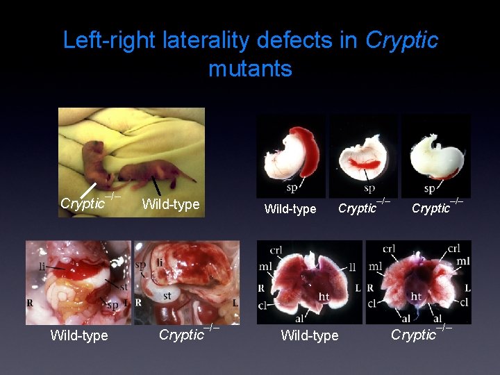 Left-right laterality defects in Cryptic mutants Cryptic –/– Wild-type Cryptic Wild-type –/– Cryptic –/–
