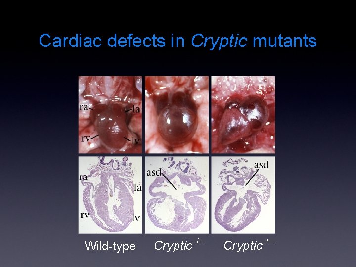 Cardiac defects in Cryptic mutants Wild-type Cryptic–/– 