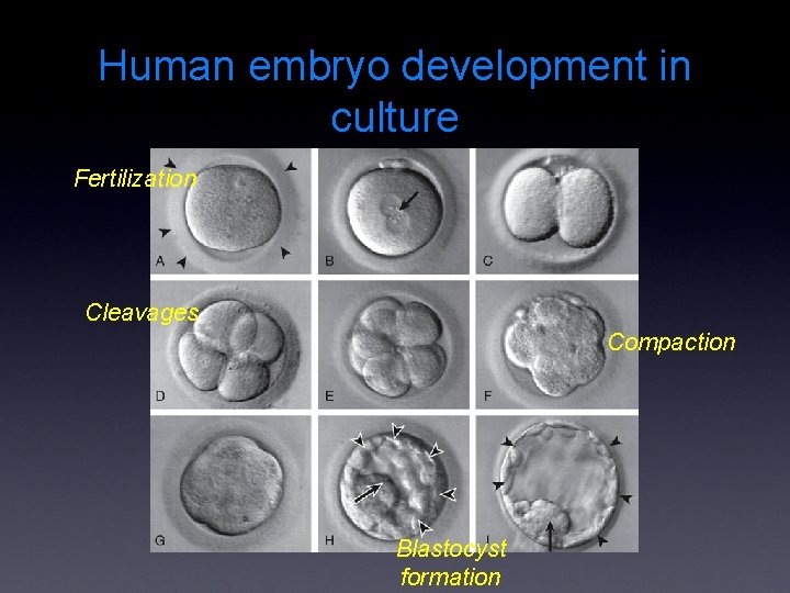 Human embryo development in culture Fertilization Cleavages Compaction Blastocyst formation 