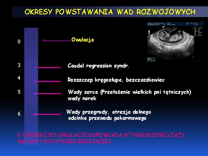 OKRESY POWSTAWANIA WAD ROZWOJOWYCH 0 Owulacja 3 Caudal regression syndr. 4 Rozszczep kręgosłupa, bezczaszkowiec