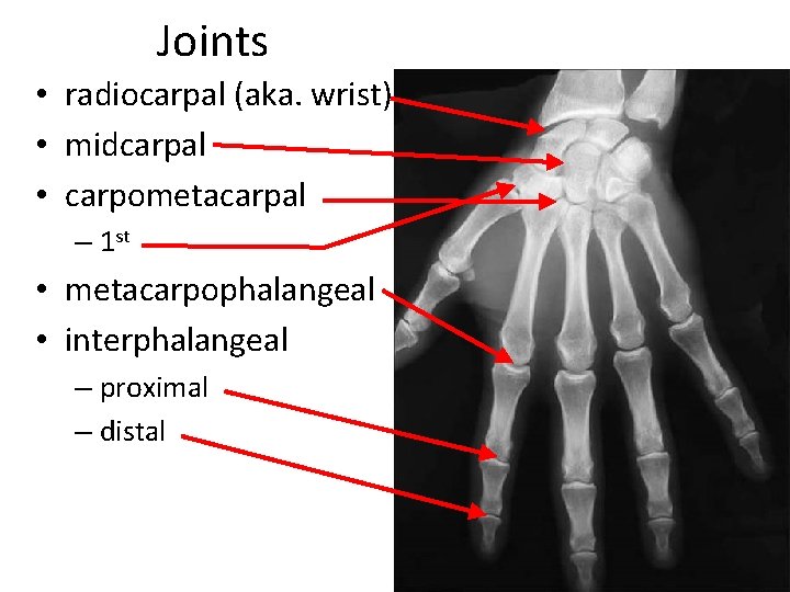 Joints • radiocarpal (aka. wrist) • midcarpal • carpometacarpal – 1 st • metacarpophalangeal