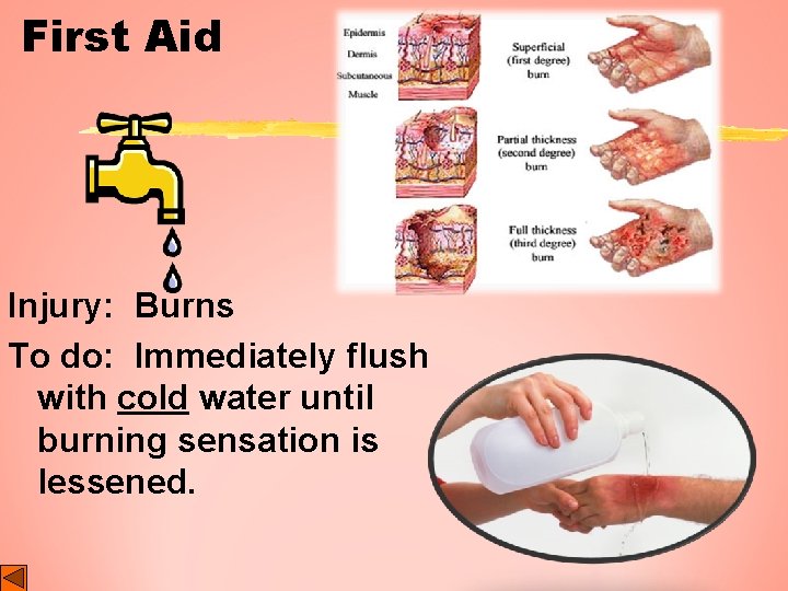 First Aid Injury: Burns To do: Immediately flush with cold water until burning sensation