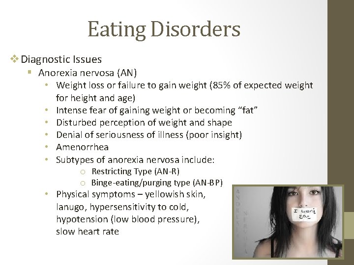 Eating Disorders v. Diagnostic Issues § Anorexia nervosa (AN) • Weight loss or failure