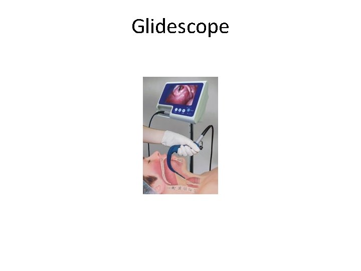 Glidescope 