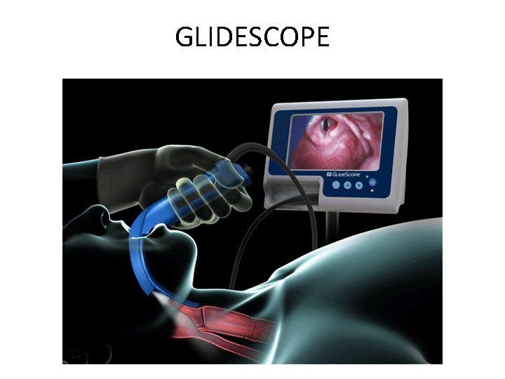 GLIDESCOPE 