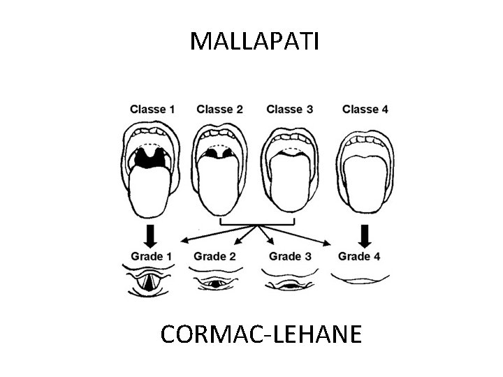 MALLAPATI CORMAC-LEHANE 