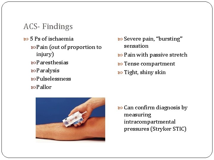 ACS- Findings 5 Ps of ischaemia Pain (out of proportion to injury) Paresthesias Paralysis