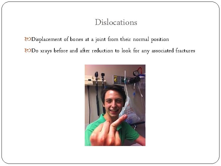 Dislocations Displacement of bones at a joint from their normal position Do xrays before