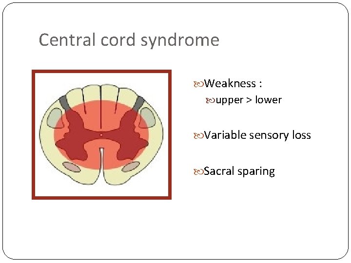 Central cord syndrome Weakness : upper > lower Variable sensory loss Sacral sparing 