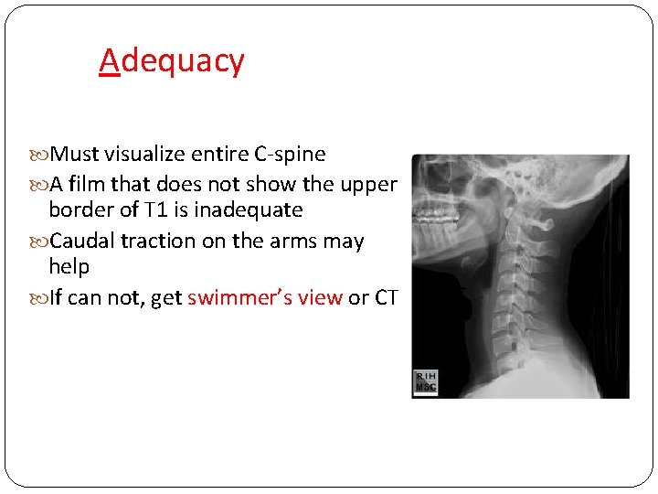 Adequacy Must visualize entire C-spine A film that does not show the upper border