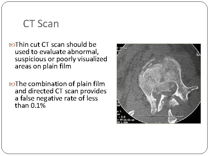CT Scan Thin cut CT scan should be used to evaluate abnormal, suspicious or