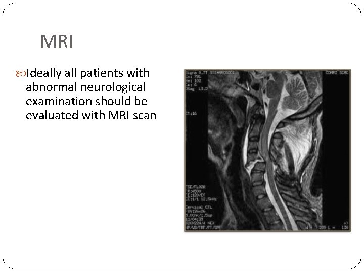 MRI Ideally all patients with abnormal neurological examination should be evaluated with MRI scan