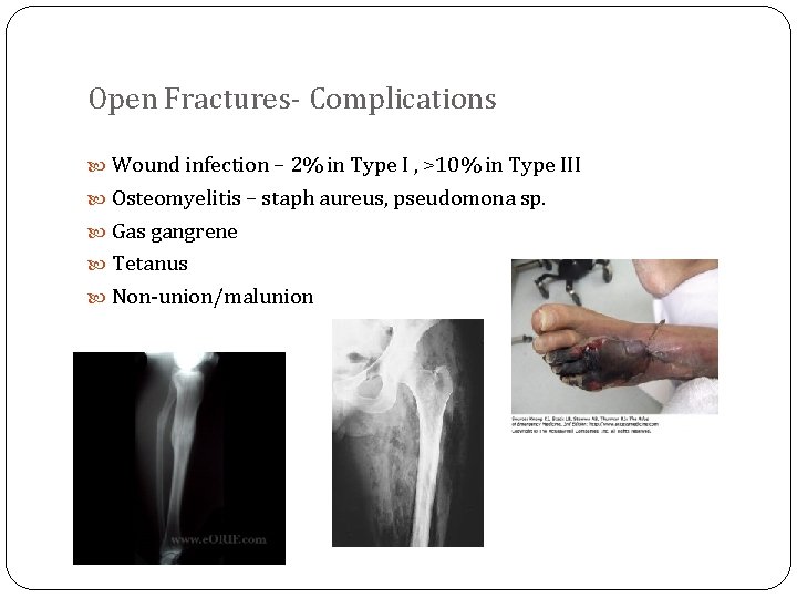 Open Fractures- Complications Wound infection – 2% in Type I , >10% in Type