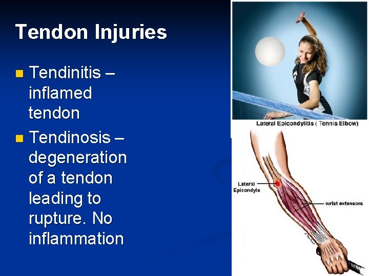 Tendon Injuries Tendinitis – inflamed tendon n Tendinosis – degeneration of a tendon leading