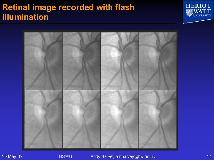 Retinal image recorded with flash illumination 25 -May-05 HSWG Andy Harvey: a. r. harvey@hw.