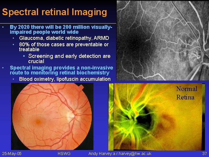 Spectral retinal Imaging • By 2020 there will be 200 million visuallyimpaired people world