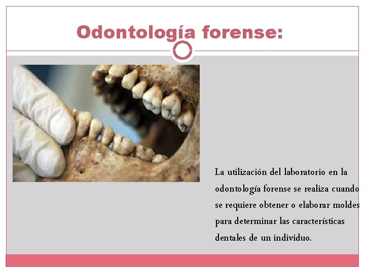 Odontología forense: La utilización del laboratorio en la odontología forense se realiza cuando se Odontología forense: La utilización del laboratorio en la odontología forense se realiza cuando se