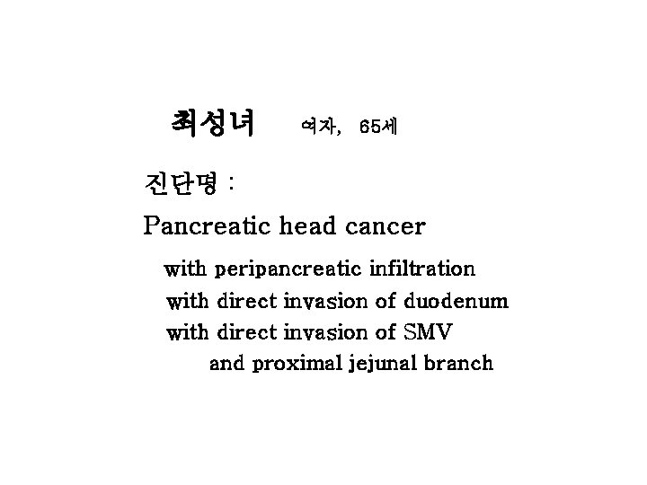 최성녀 여자, 65세 진단명 : Pancreatic head cancer with peripancreatic infiltration with direct invasion