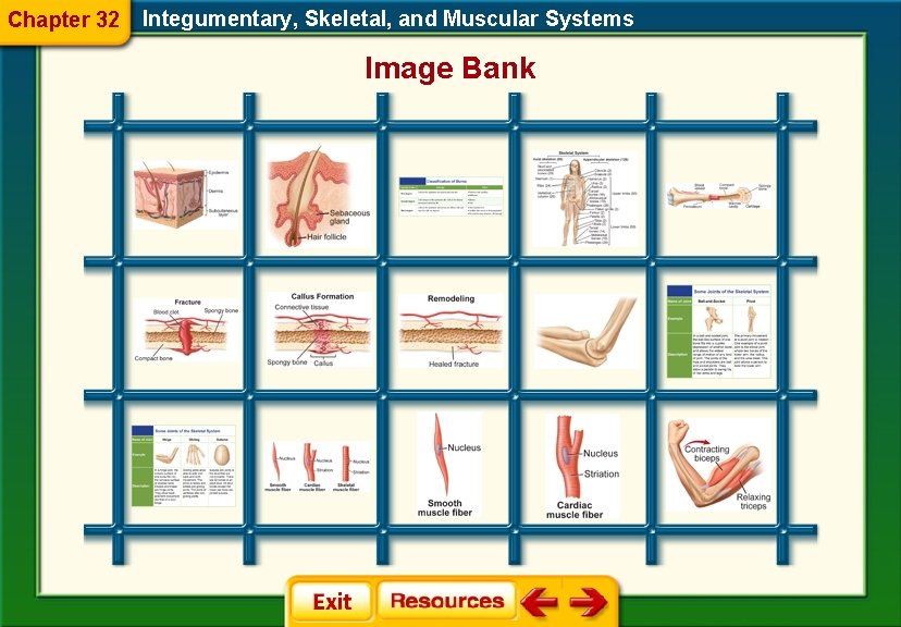 Chapter 32 Integumentary, Skeletal, and Muscular Systems Image Bank 