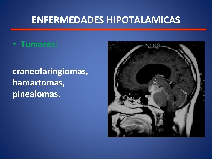 TRASTORNOS HIPOTALAMOHIPOFISIARIOS DR Medina Enfermedades del Sistema ...