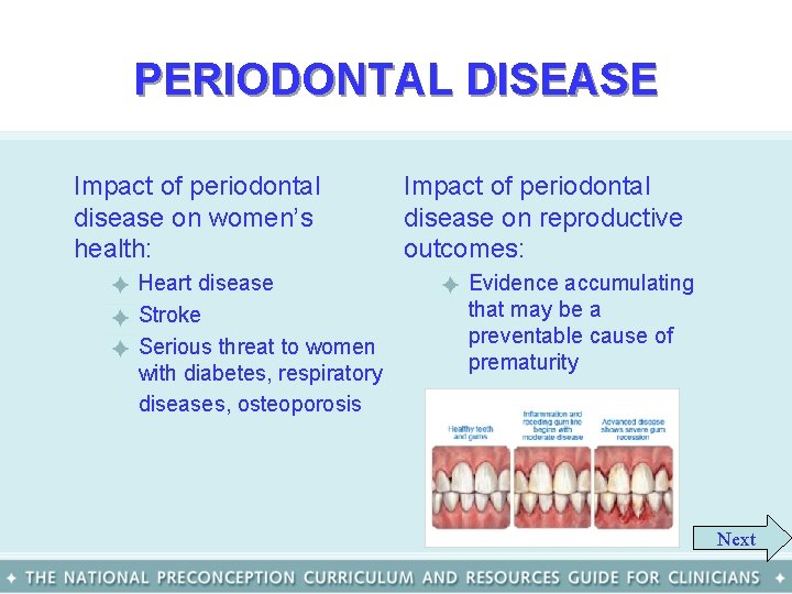 PERIODONTAL DISEASE Impact of periodontal disease on women’s health: – Heart disease – Stroke