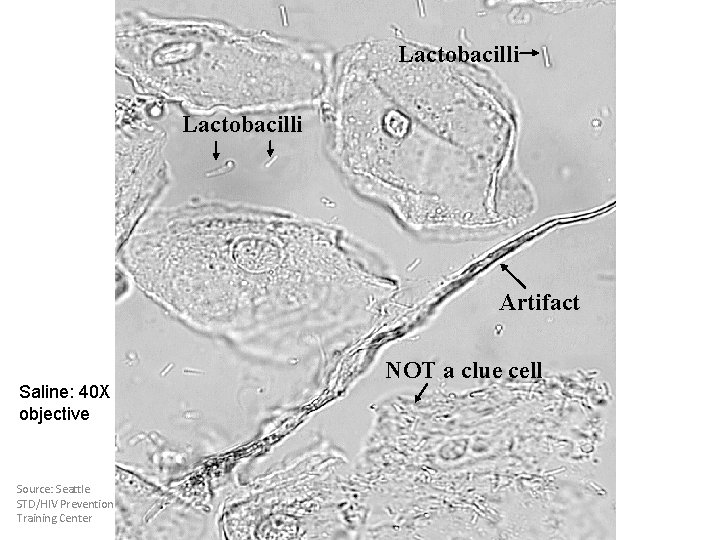 Lactobacilli Artifact Saline: 40 X objective Source: Seattle STD/HIV Prevention Training Center NOT a