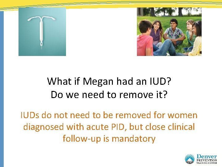What if Megan had an IUD? Do we need to remove it? IUDs do