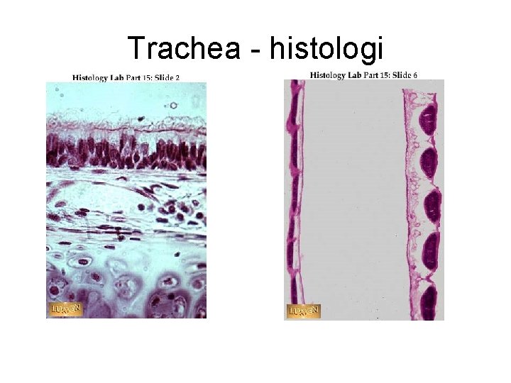 Trachea - histologi 