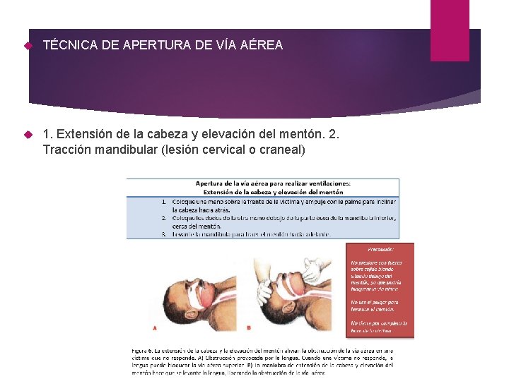  TÉCNICA DE APERTURA DE VÍA AÉREA 1. Extensión de la cabeza y elevación