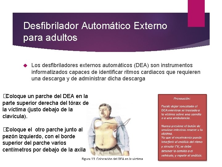 Desfibrilador Automático Externo para adultos Los desfibriladores externos automáticos (DEA) son instrumentos informatizados capaces