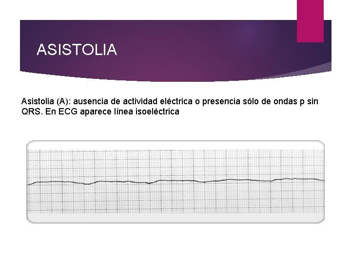 ASISTOLIA Asistolia (A): ausencia de actividad eléctrica o presencia sólo de ondas p sin