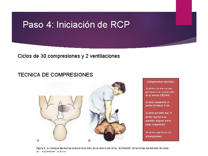 Paso 4: Iniciación de RCP Ciclos de 30 compresiones y 2 ventilaciones TECNICA DE