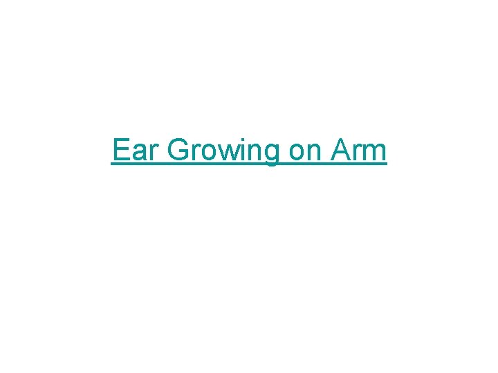 Ear Growing on Arm 