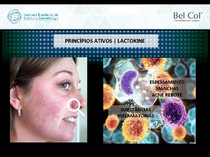 PRINCÍPIOS ATIVOS | LACTOKINE ESPESSAMENTO MANCHAS ACNE REBOTE SUBST NCIAS INFLAMATÓRIAS 
