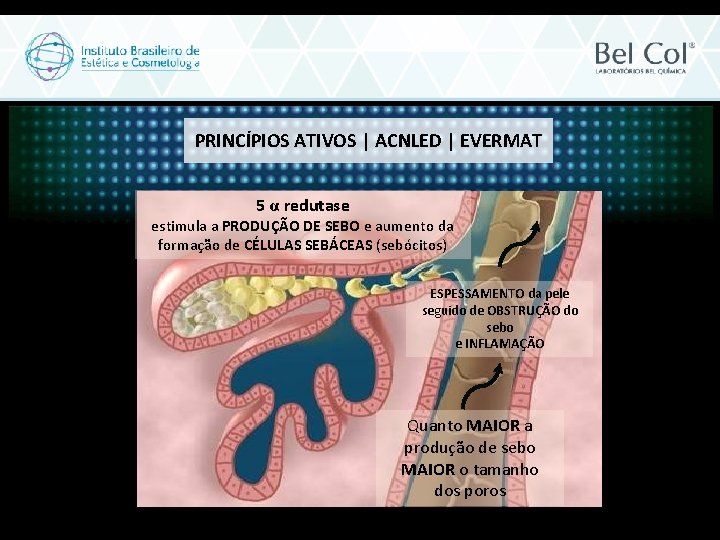 PRINCÍPIOS ATIVOS | ACNLED | EVERMAT 5 α redutase estimula a PRODUÇÃO DE SEBO