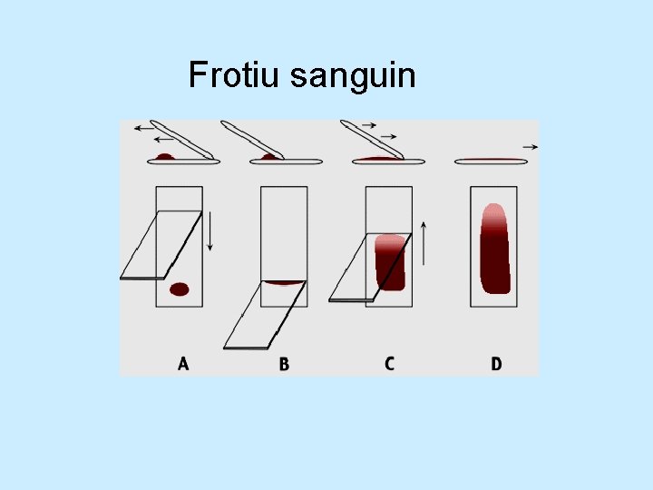 Frotiu sanguin Frotiu sanguin